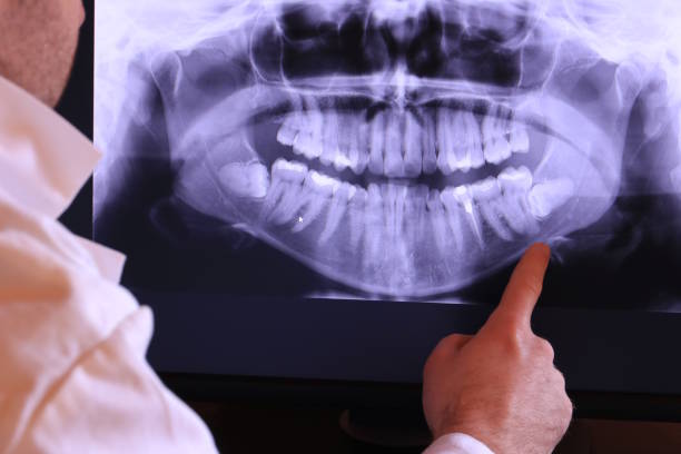 Best Cracked Tooth Emergency Dentist  in Ashland, OR
