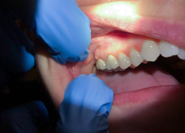 Best Emergency Gum Pain Relief  in Ashland, OR